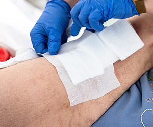 Soin de l’escarre, une plaie de santé publique