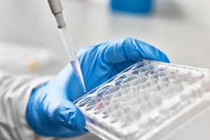 Cette variante génétique du gène OAS1 pourrait ainsi augmenter le risque de maladie d'Alzheimer jusqu’à 6% en population générale, des variantes apparentées du même gène augmentant le risque de forme sévère et de complications de COVID-19 (Visuel Adobe Stock 142855037)