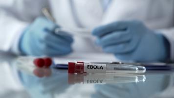 Ces travaux retracent tout le cheminement du virus Ebola de l'intérieur du corps vers la surface de la peau (Visuel Adobe Stock 204195802)