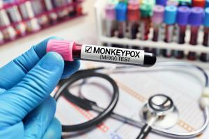 Bien que les cas de mPox aient fortement diminué depuis l'épidémie mondiale de 2022, la variole du singe continue de circuler à bas bruit chez les hommes ayant des rapports sexuels avec des hommes HSH) (Visuel Adobe Stock 506616350) Bien que les cas de mPox aient fortement diminué depuis l'épidémie mondiale de 2022, la variole du singe continue de circuler à bas bruit chez les hommes ayant des rapports sexuels avec des hommes HSH) (Visuel Adobe Stock 506616350)