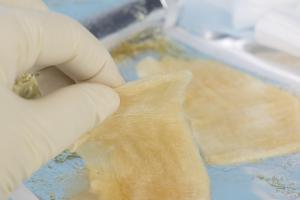 Il s'agit un hydrogel multiforme à base de nanofibres de cellulose capables d’encapsuler et de délivrer des cellules toutes neuves. Il s'agit un hydrogel multiforme à base de nanofibres de cellulose capables d’encapsuler et de délivrer des cellules toutes neuves.