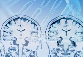 Cette nouvelle thérapie génique vise à inhiber la fonction d'une famille de gènes, HOX, responsable de la croissance de la tumeur (Visuel Adobe Stock 241817004) Cette nouvelle thérapie génique vise à inhiber la fonction d'une famille de gènes, HOX, responsable de la croissance de la tumeur (Visuel Adobe Stock 241817004)