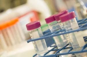 3 protéines clés, le récepteur des glucocorticoïdes (GR), le récepteur des minéralocorticoïdes (MR) et la protéine de liaison au FK506 51 (FKBP5) - interagissent les unes avec les autres pour réguler la réponse au stress (Visuel McLean Hospital) 3 protéines clés, le récepteur des glucocorticoïdes (GR), le récepteur des minéralocorticoïdes (MR) et la protéine de liaison au FK506 51 (FKBP5) - interagissent les unes avec les autres pour réguler la réponse au stress (Visuel McLean Hospital)