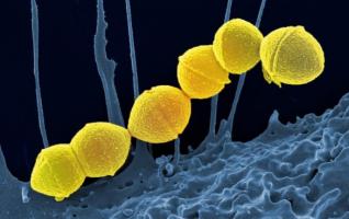 Les chercheurs de la Georgia Tech appellent aujourd’hui à développer des alternatives aux antibiotiques pour traiter les infections courantes Les chercheurs de la Georgia Tech appellent aujourd’hui à développer des alternatives aux antibiotiques pour traiter les infections courantes
