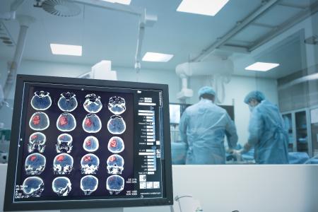 Un mini-AVC peut-il entraîner une fatigue durable ? (Visuel Adobe Stock 123251630)