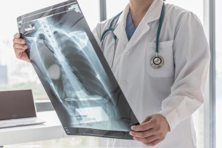 L'étude contribue à expliquer pourquoi les médicaments plus récents ne parviennent pas toujours à empêcher des lésions pulmonaires permanentes (Visuel Adobe Stock 254908648). 