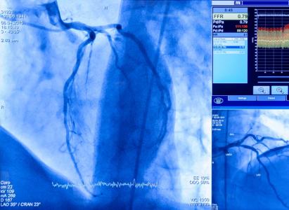 Pourquoi l’avantage du médicament va bien au-delà du simple report de l'intervention chirurgicale (Visuel Adobe Stock 527681350)