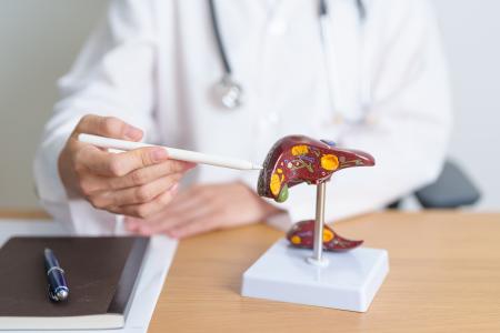 Les patients atteints d'une maladie hépatique chronique et présentant une hypertension artérielle, un prédiabète/diabète ou un faible taux de cholestérol HDL sont les plus à risque de décès (Visuel Adobe Stock 610518865)