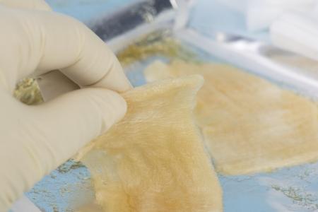 Il s'agit un hydrogel multiforme à base de nanofibres de cellulose capables d’encapsuler et de délivrer des cellules toutes neuves.