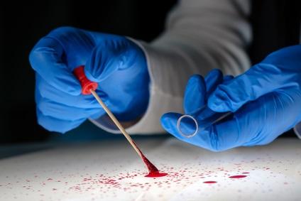 CancerSEEK est un test sanguin capable de détecter, de manière précoce et avec 99% de spécificité, 8 types de cancers, parmi les plus courants. 