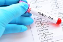 La durée de vie avec une hémoglobine glyquée (HbA1c) -une métrique standard de la glycémie- dans la plage recommandée est bien un facteur de réduction du risque de démence chez les personnes âgées diabétiques (Visuel Adobe Stock 211144940) La durée de vie avec une hémoglobine glyquée (HbA1c) -une métrique standard de la glycémie- dans la plage recommandée est bien un facteur de réduction du risque de démence chez les personnes âgées diabétiques (Visuel Adobe Stock 211144940)