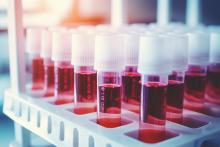 Pourtant remise en exergue en pleine pandémie COVID, la stratégie par plasma thérapeutique aura été peu utilisée (Visuel Adobe Stock 656634784) Pourtant remise en exergue en pleine pandémie COVID, la stratégie par plasma thérapeutique aura été peu utilisée (Visuel Adobe Stock 656634784)