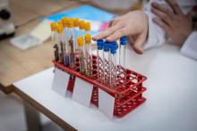 Le rôle des polyphénols dans la prévention et le traitement des maladies est aujourd’hui si puissant que ces antioxydants ont leur congrès (Visuel Adobe Stock 792069616) Le rôle des polyphénols dans la prévention et le traitement des maladies est aujourd’hui si puissant que ces antioxydants ont leur congrès (Visuel Adobe Stock 792069616)