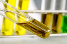 Jusque-là plutôt considéré comme un facteur d’inflammation, cet omega-6, l’acide linoléique, présent dans les huiles à base de graines, pourrait, au contraire, contribuer à réduire les risques de maladies cardiaques et de diabète de type 2 (Visuel Adobe Stock 299937062) Jusque-là plutôt considéré comme un facteur d’inflammation, cet omega-6, l’acide linoléique, présent dans les huiles à base de graines, pourrait, au contraire, contribuer à réduire les risques de maladies cardiaques et de diabète de type 2 (Visuel Adobe Stock 299937062)