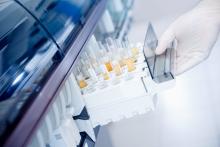 Cette équipe de néphrologues révise, pour plus de précision, la définition de l'hyperfiltration rénale, ou taux de filtration glomérulaire trop élevé, un marqueur biologique de développement de la maladie rénale (Visuel Adobe Stock 334065984)