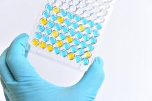 Mieux « cerner » les protéines associées à la maladie de Parkinson, présentes dans les vésicules extracellulaires en circulation dans le sang, pourrait permettre le développement d’un test sanguin de précision et de détection de la maladie (Visuel Adobe Stock 340972951) Mieux « cerner » les protéines associées à la maladie de Parkinson, présentes dans les vésicules extracellulaires en circulation dans le sang, pourrait permettre le développement d’un test sanguin de précision et de détection de la maladie (Visuel Adobe Stock 340972951)